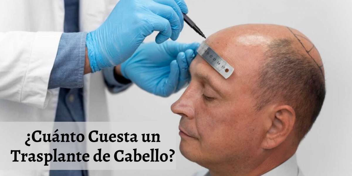 ¿Cuánto Cuesta un Trasplante de Cabello?