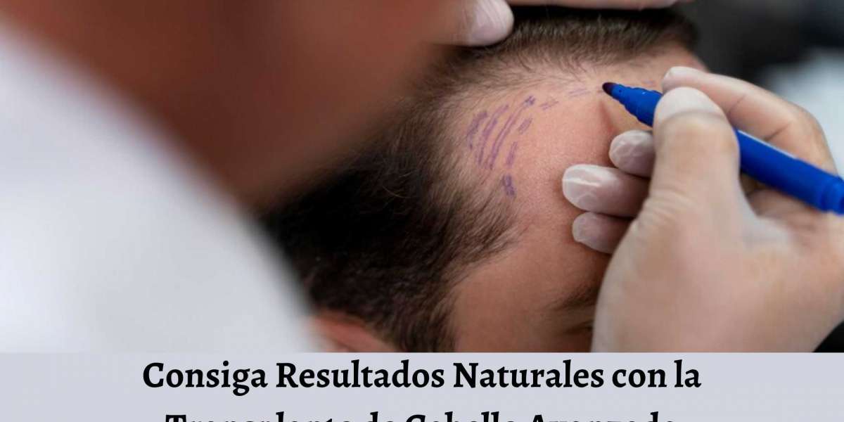 Consiga Resultados Naturales con la Transplante de Cabello Avanzada